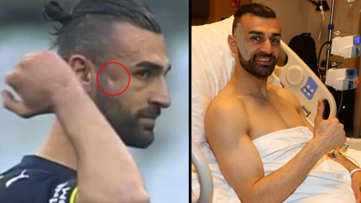 Elmacık kemiğine darbe alan Fenerbahçe’nin forveti Serdar Dursun ameliyat oldu